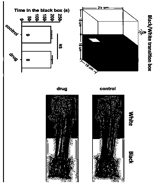 Application of L-aspartic acid beta-hydroxamate in preparation of drugs for inhibiting choroidal neovascularization, and choroidal neovascularization treatment method