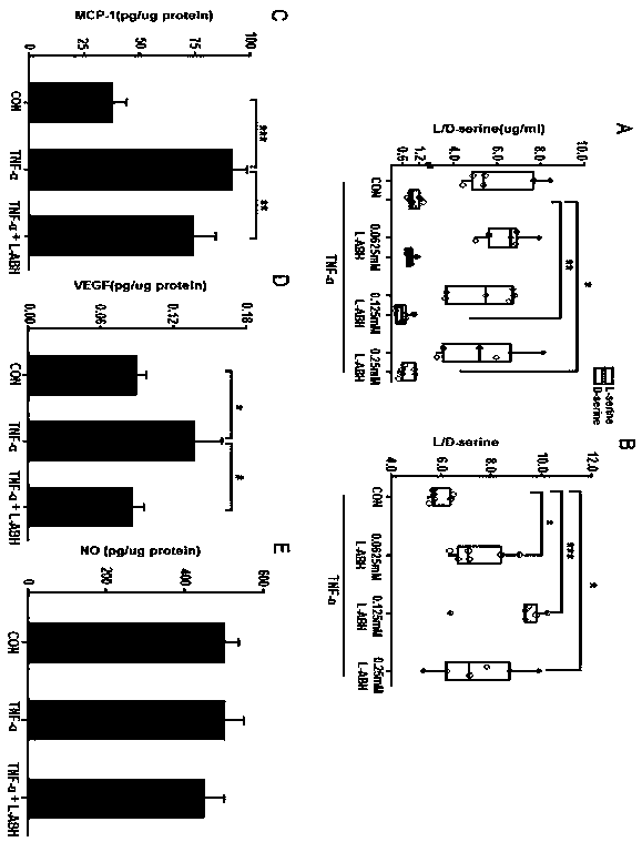 Application of L-aspartic acid beta-hydroxamate in preparation of drugs for inhibiting choroidal neovascularization, and choroidal neovascularization treatment method