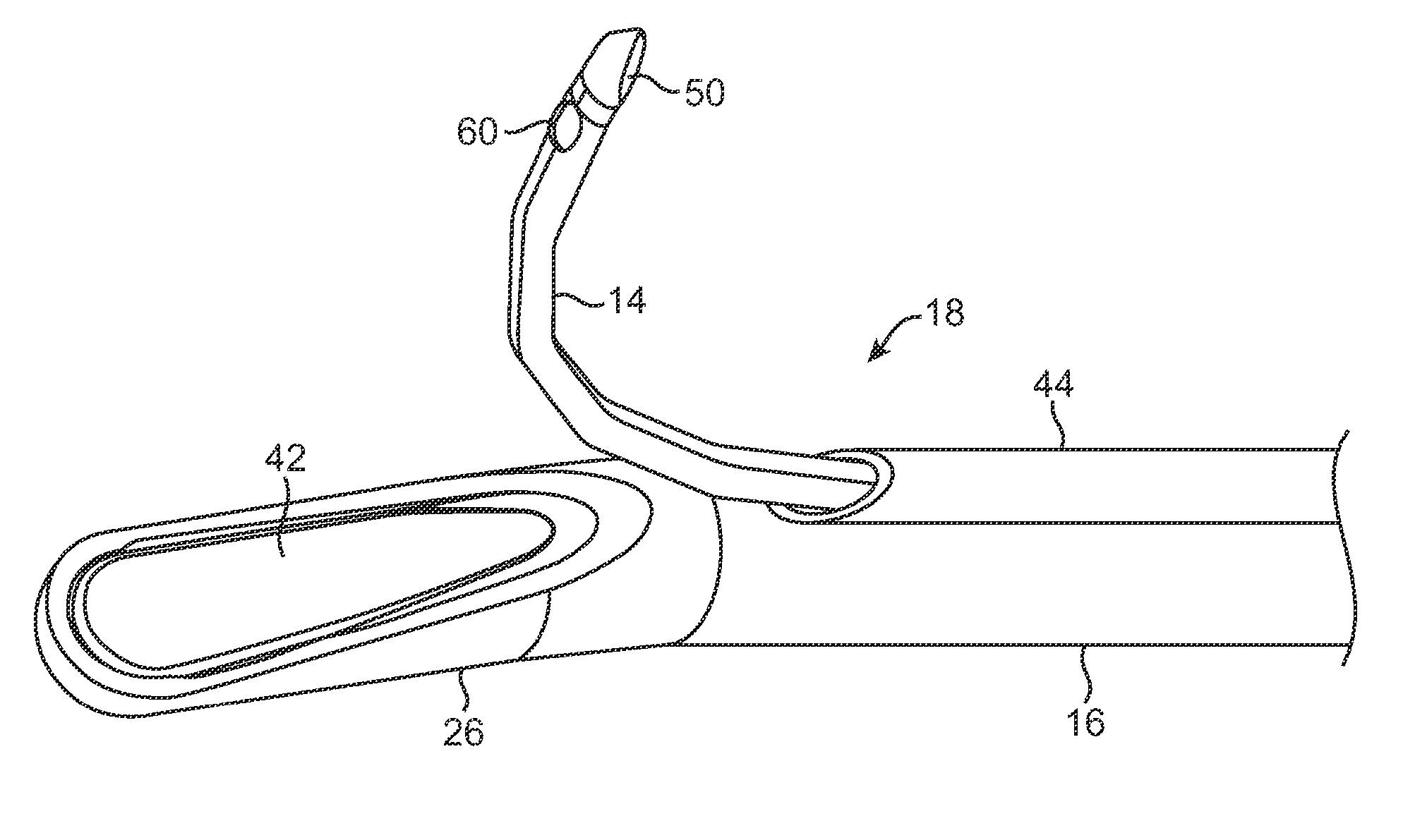 Rigid delivery systems having inclined ultrasound and needle