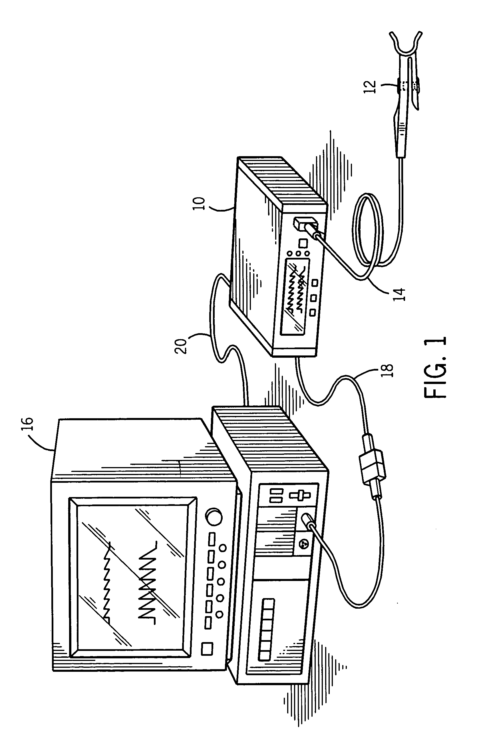 Method and apparatus for detection of venous pulsation
