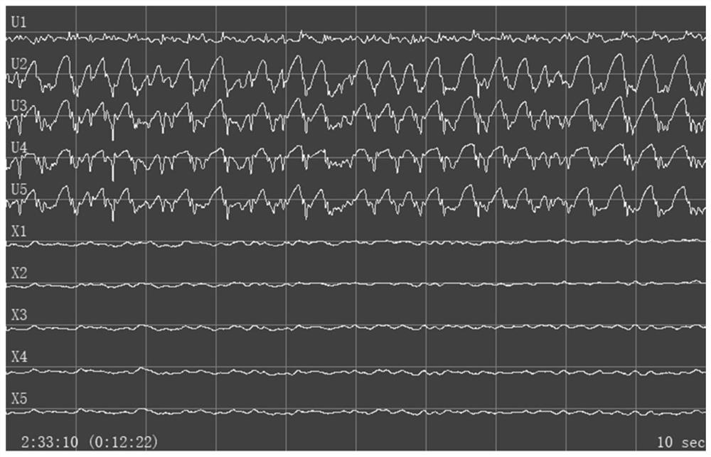 Coupled neuron group-based electroencephalogram activity simulation method and system