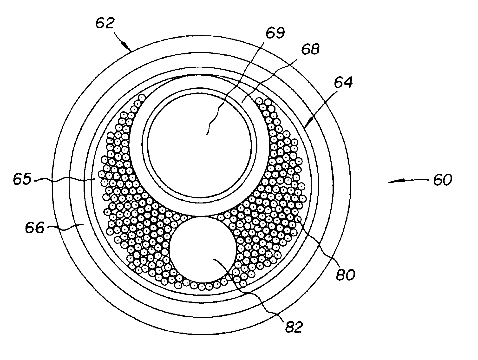 Apparatus and method for intraductal cytology
