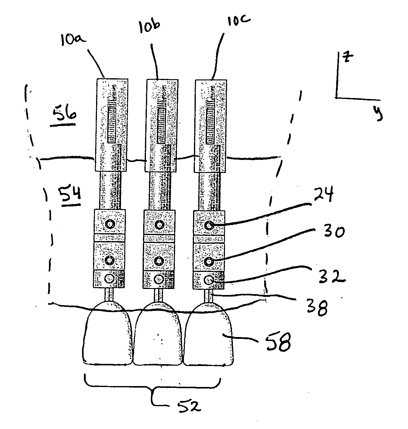 Method and apparatus for repositioning teeth