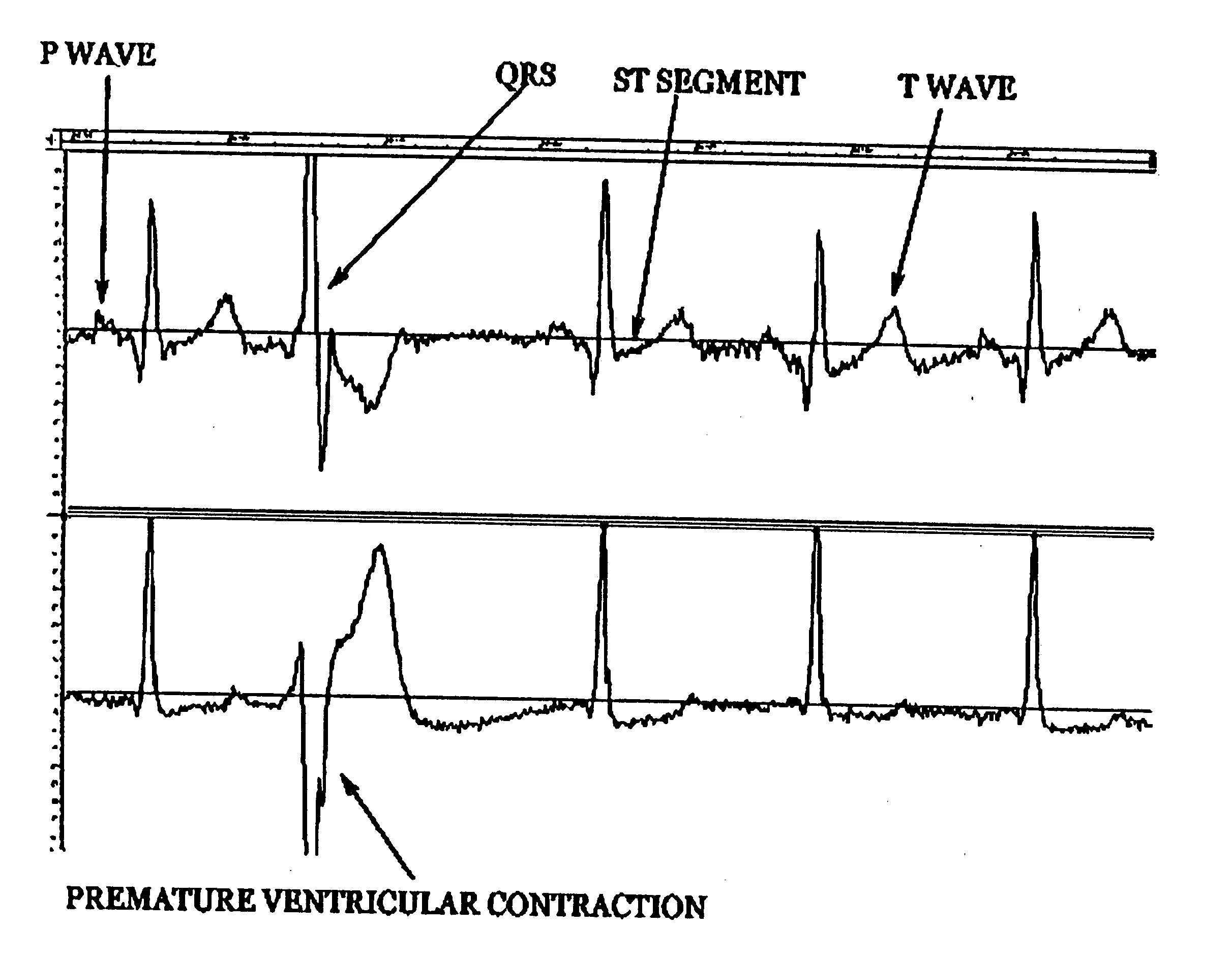 System for analysis of biological voltage signals