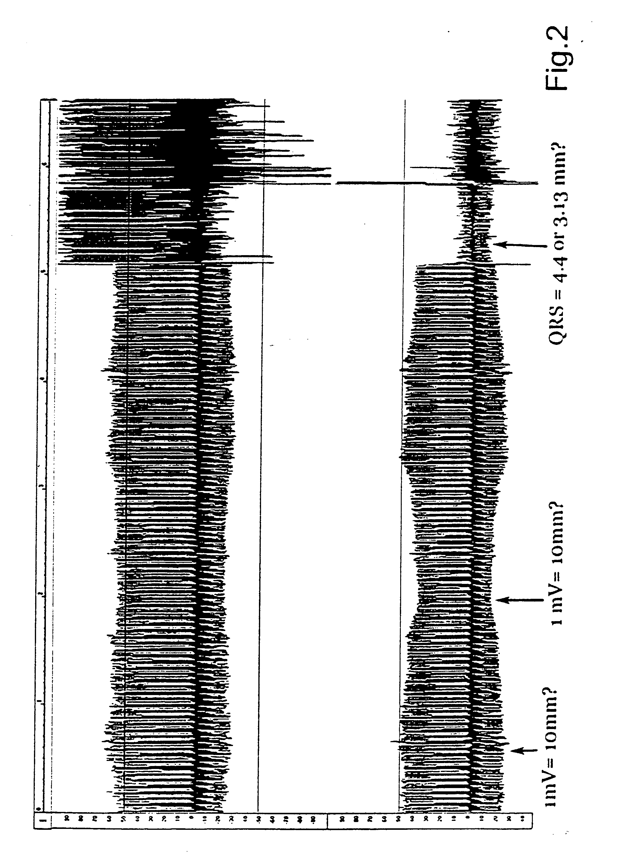 System for analysis of biological voltage signals