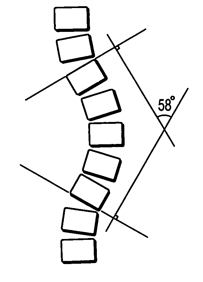 Systems and methods for computer aided detection of spinal curvature using images and angle measurements