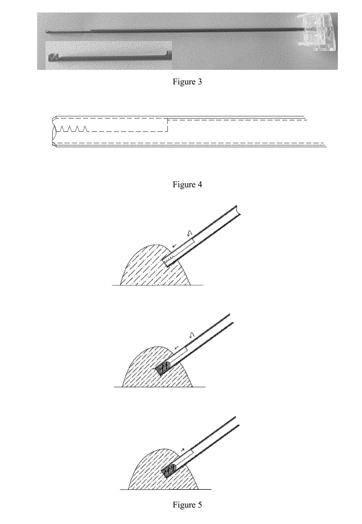 Spiral soft tissue biopsy needle