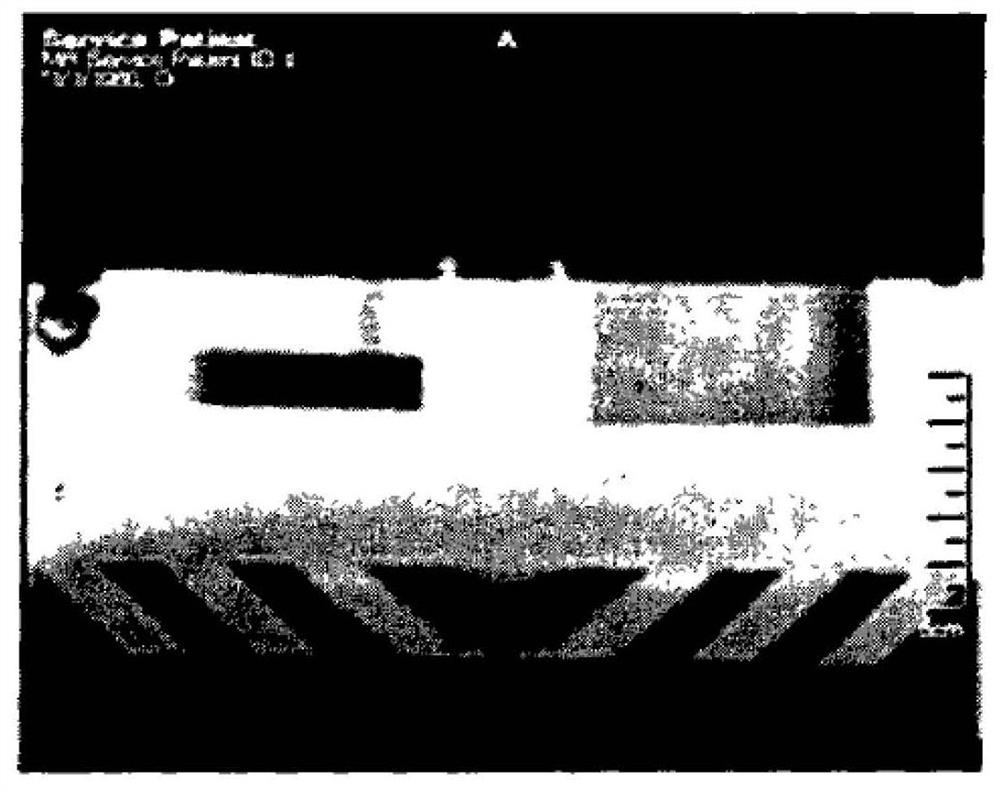 Optimizing Method of Ultrasonic Focus Positioning Image