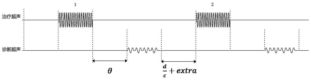 Optimizing Method of Ultrasonic Focus Positioning Image