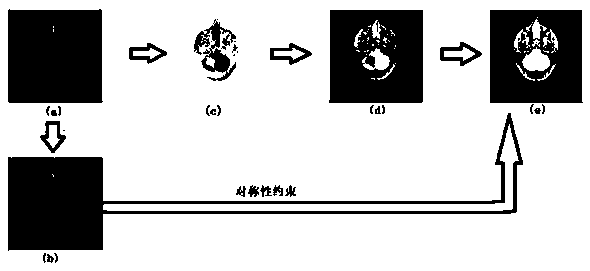 Brain MR medical image registration method