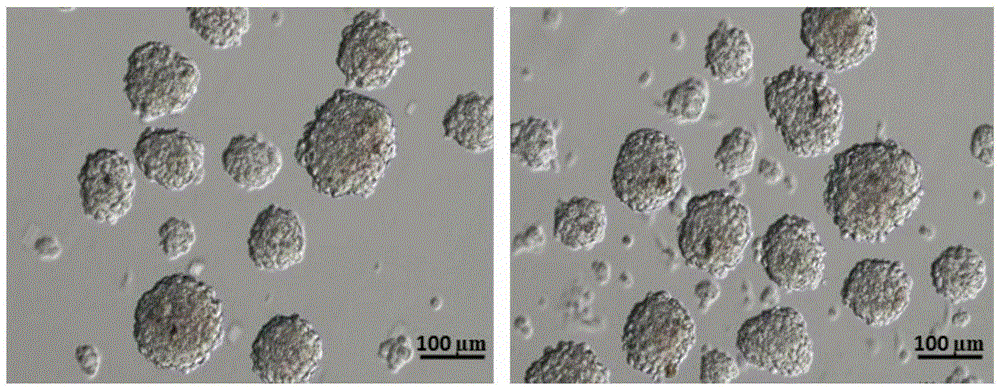 Method for obtaining haploid germ cells through in-vitro differentiation of human skin stem cells