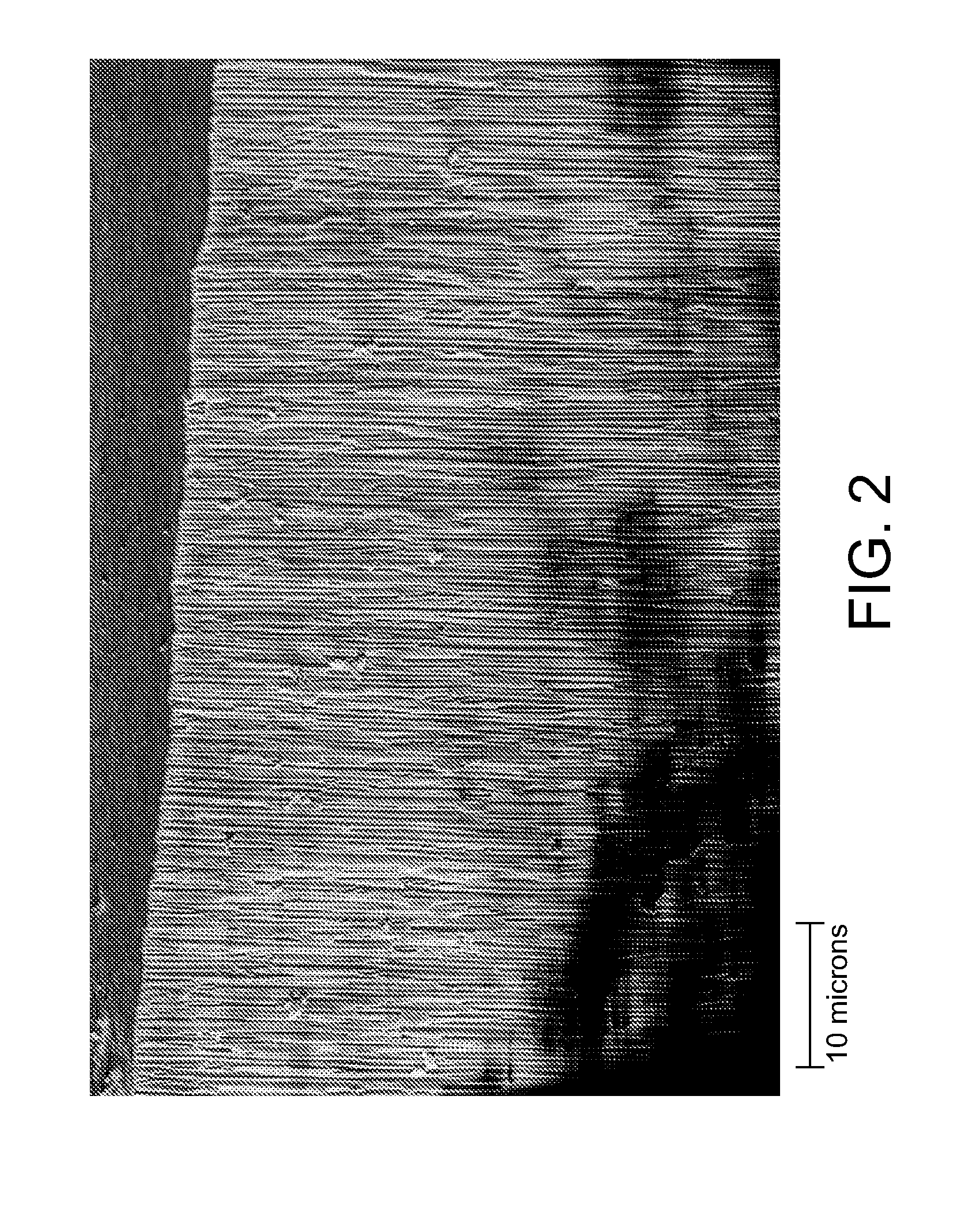 Nanostructure electrode for pseudocapacitive energy storage