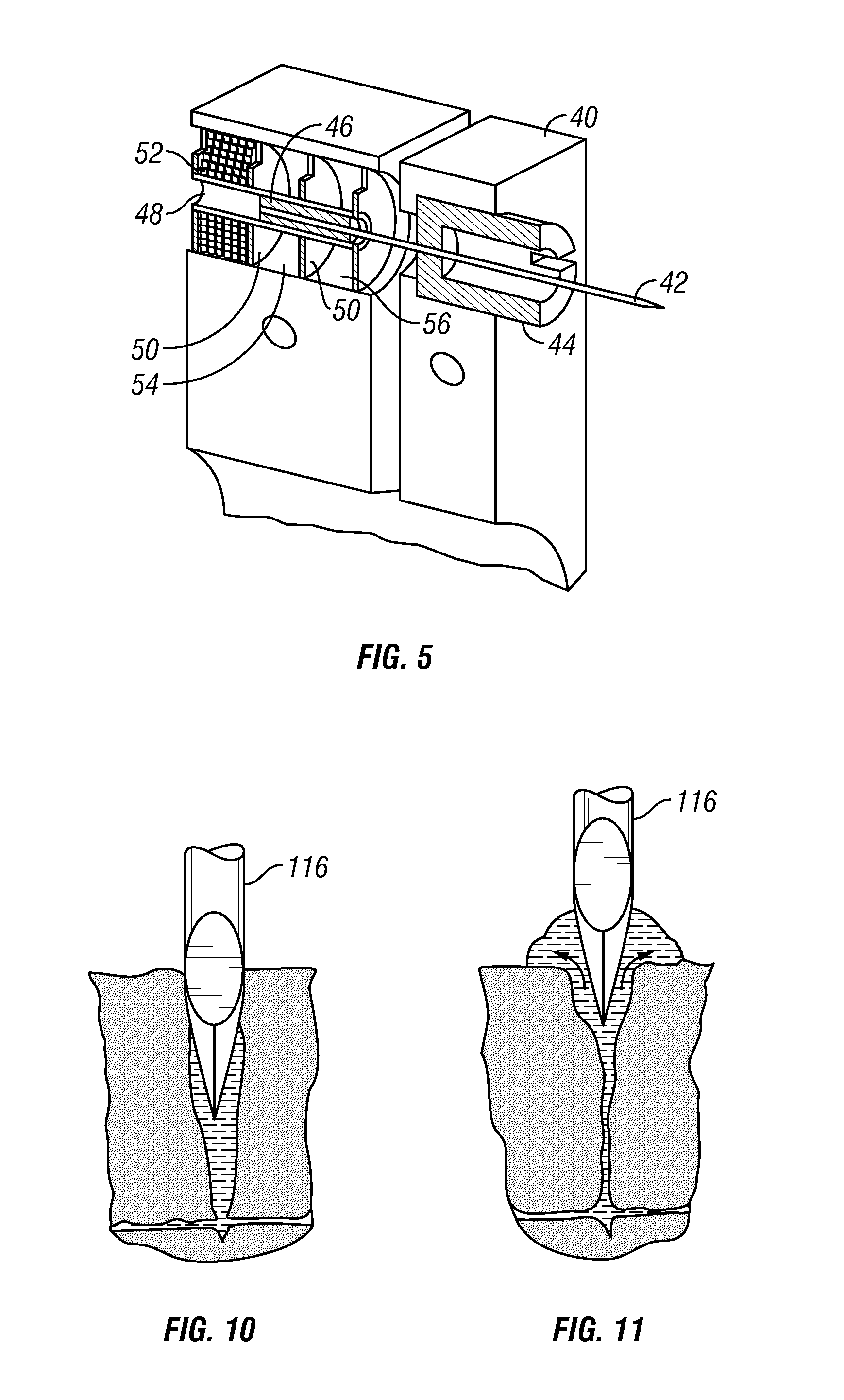 Tissue Penetrating Apparatus