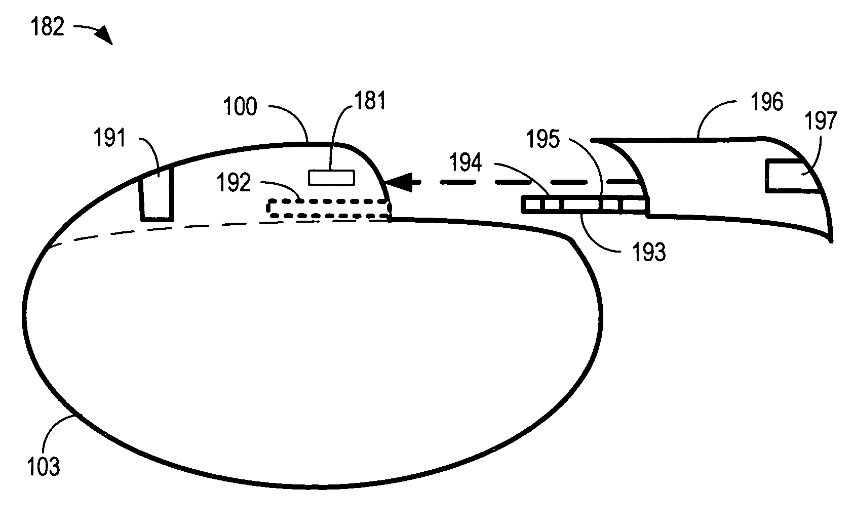 Reconfigurable implantable cardiac monitoring and therapy delivery device