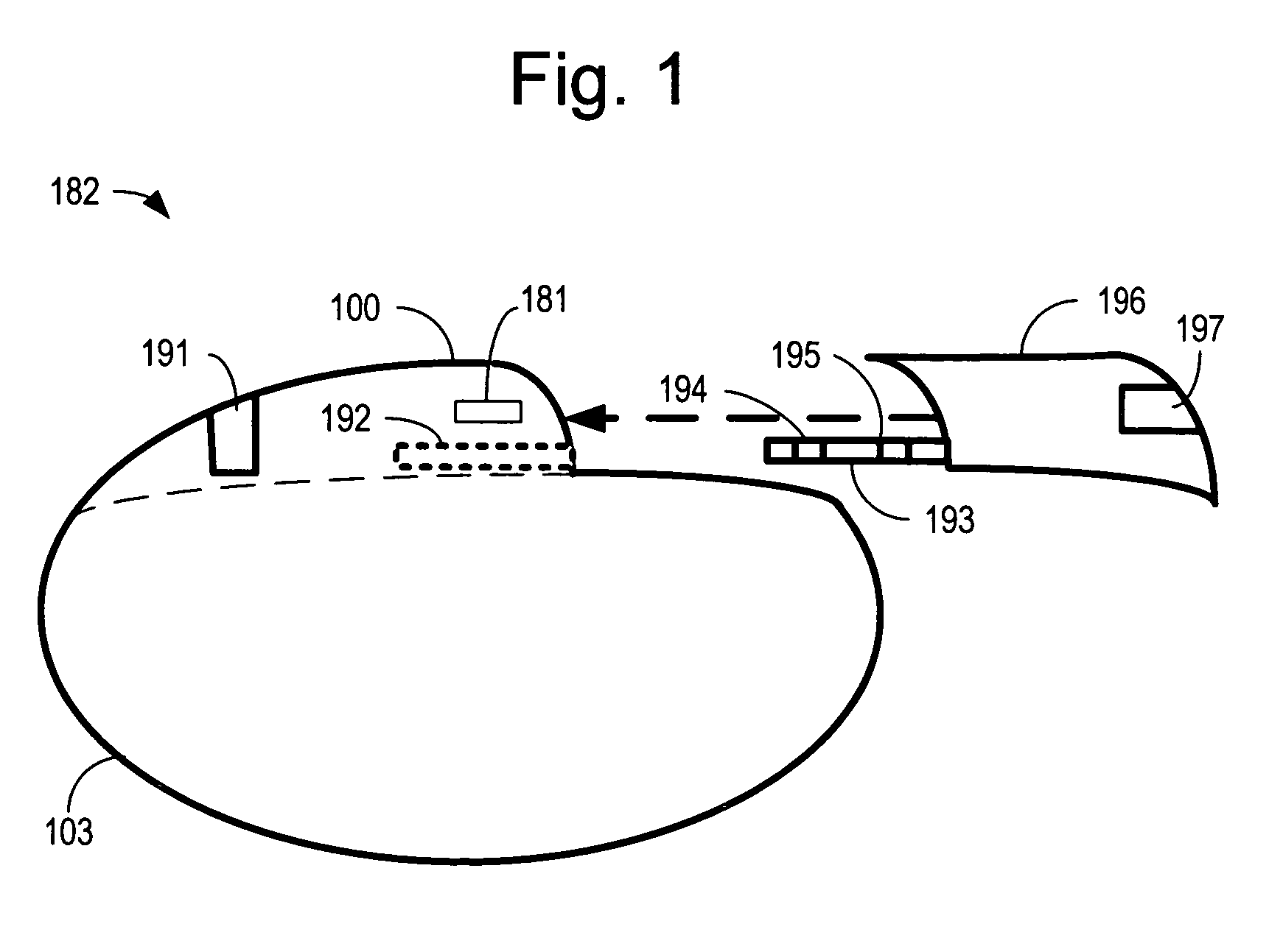 Reconfigurable implantable cardiac monitoring and therapy delivery device