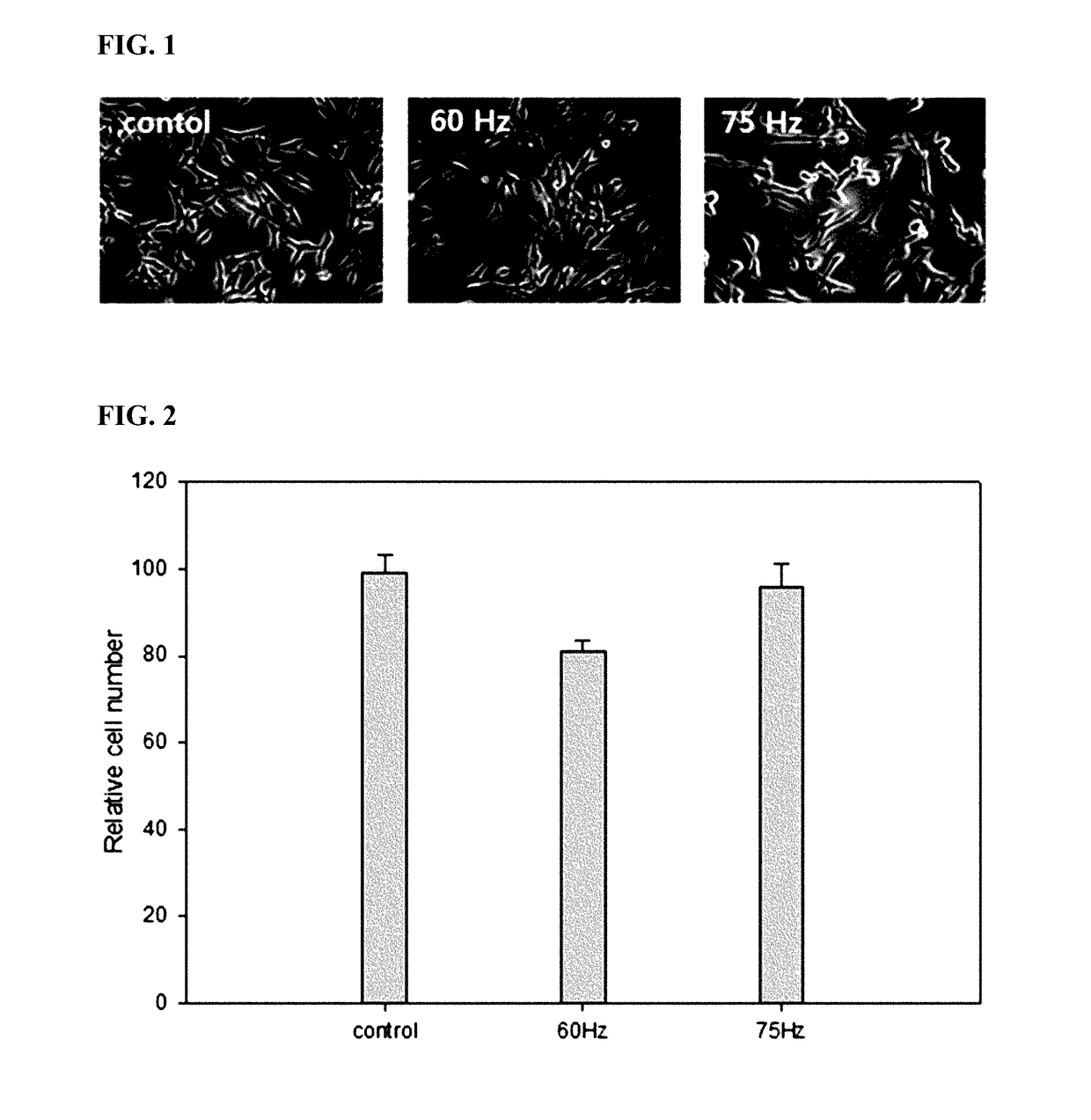 Method of differentiating adult stem cells into nerve cells by using high-intensity electromagnetic field