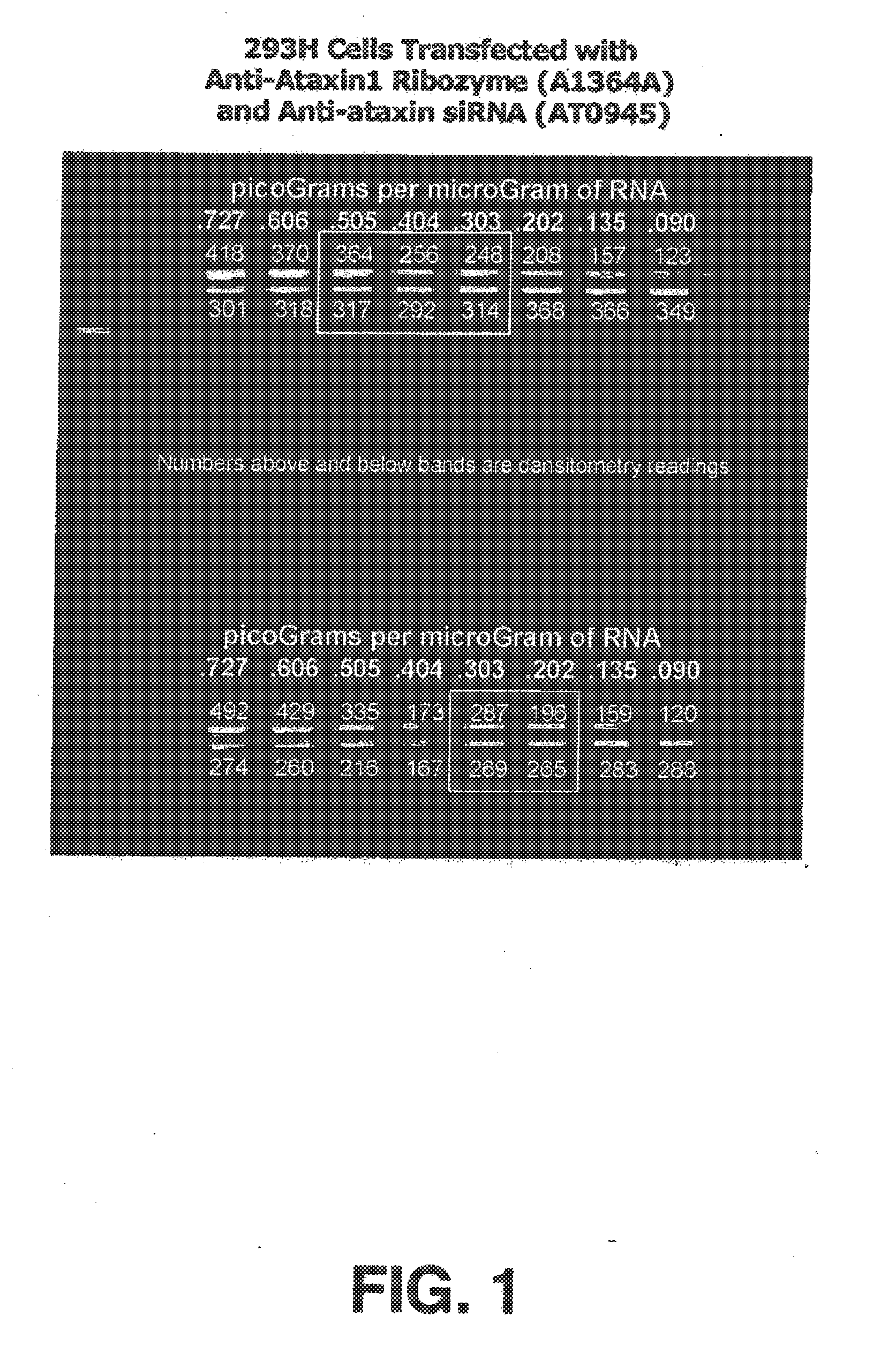 Compositions, devices and methods for treatment of huntington's disease through intracranial delivery of sirna