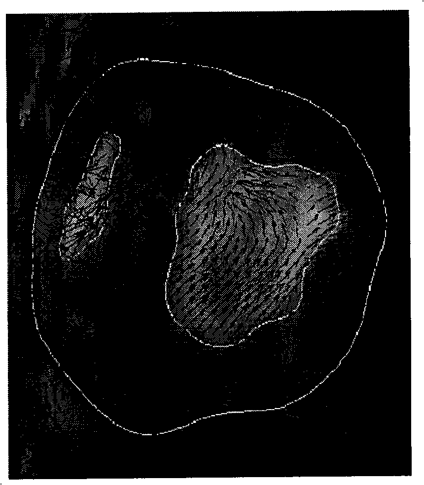 Method for processing heart movement sequence image by computer