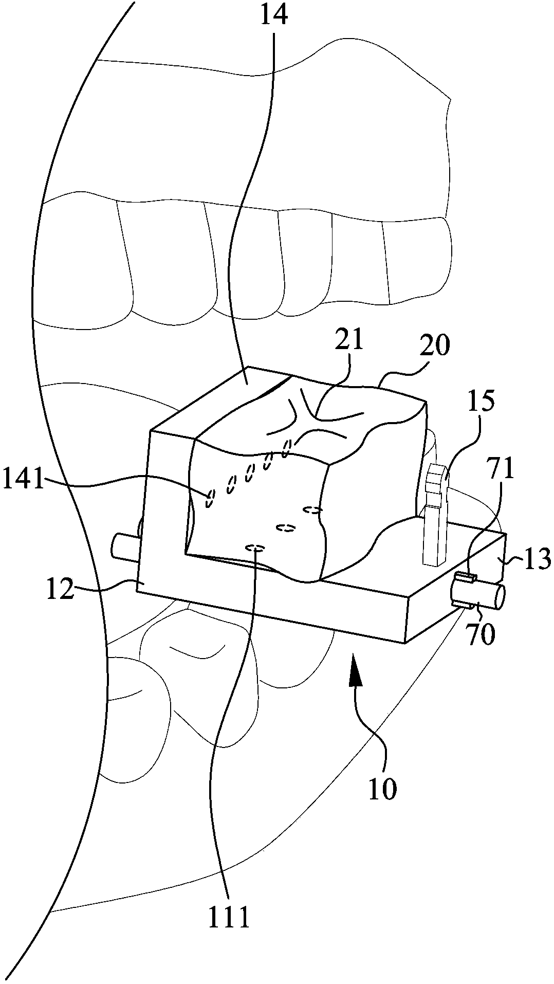 Positioning and measurement device for oral cavity implant correction operation