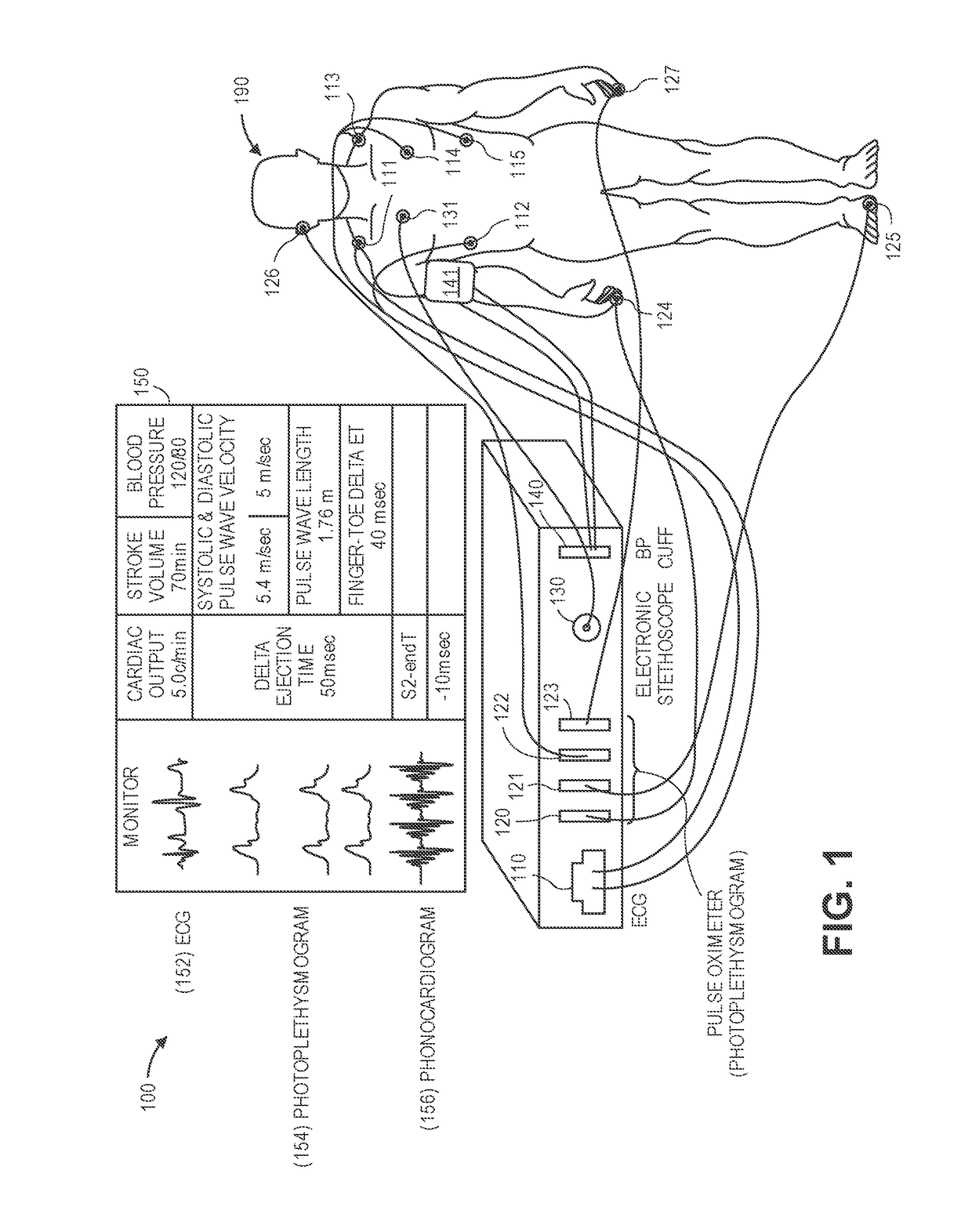 Novel device and method to measure ventricular arterial coupling and vascular performance