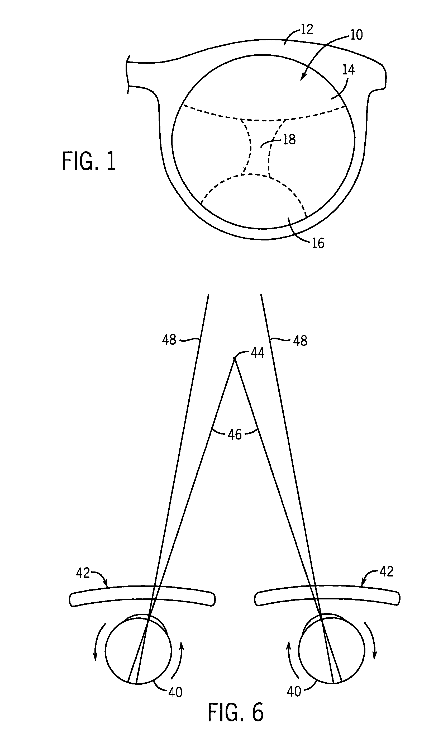 Multi-focal ophthalmic lens with base in prism