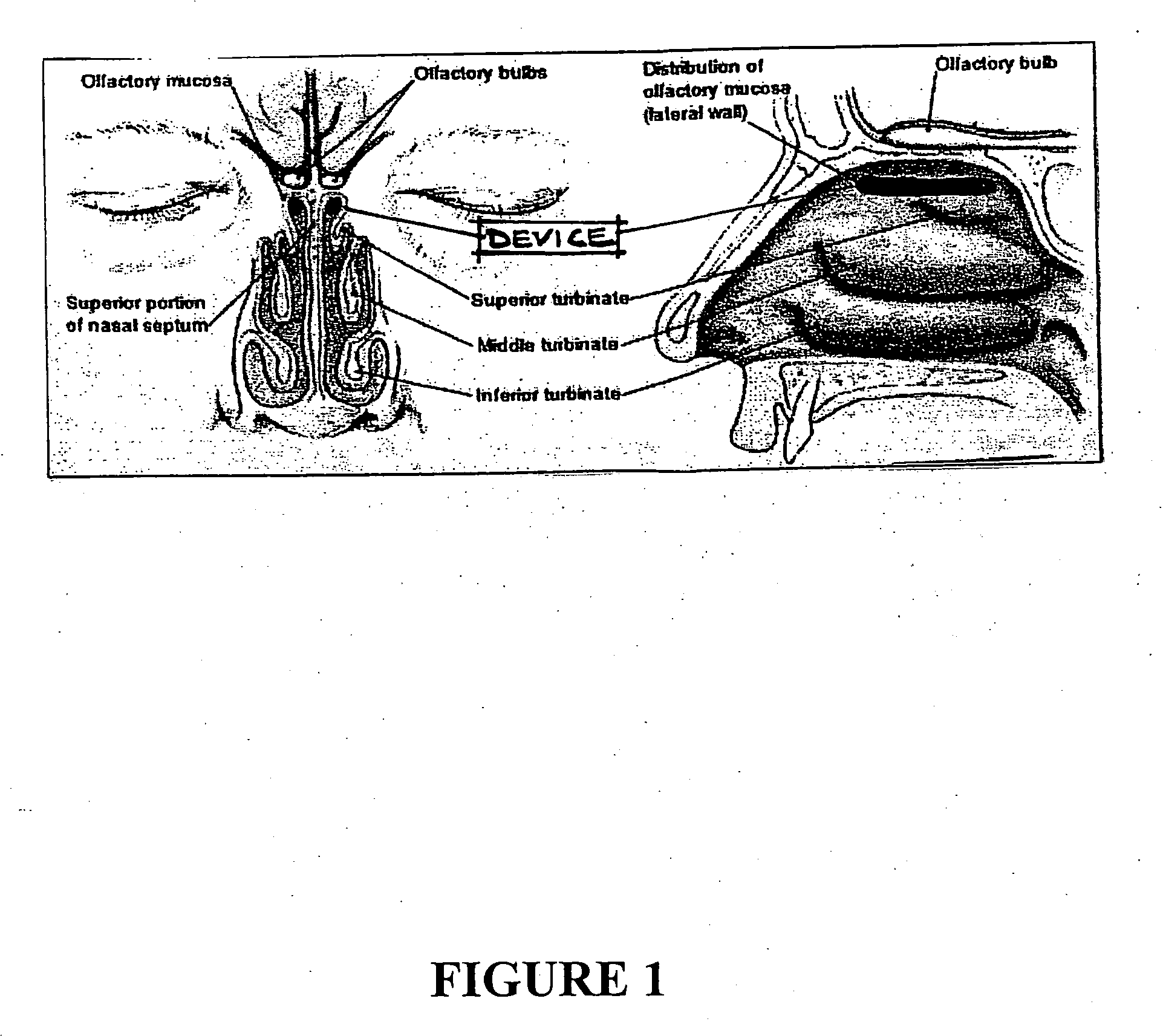Apparatus and methods for diet and weight control by suppressing the sense of smell and taste