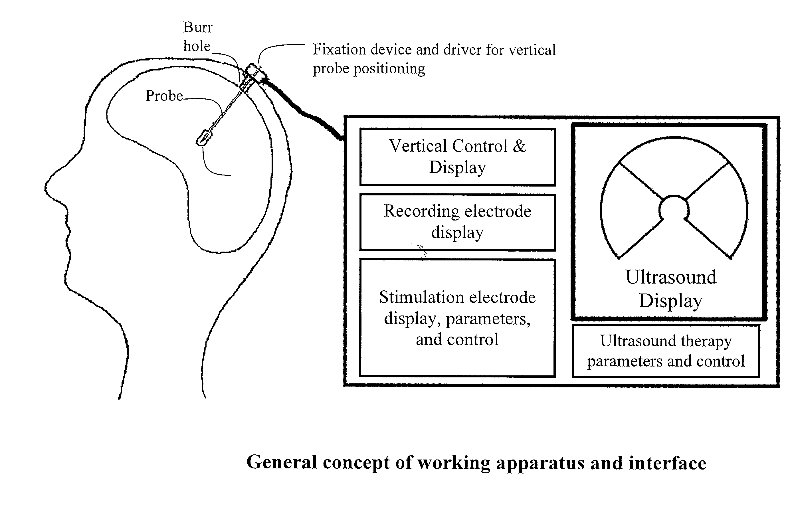 Hybrid ultrasound/electrode device for neural stimulation and recording
