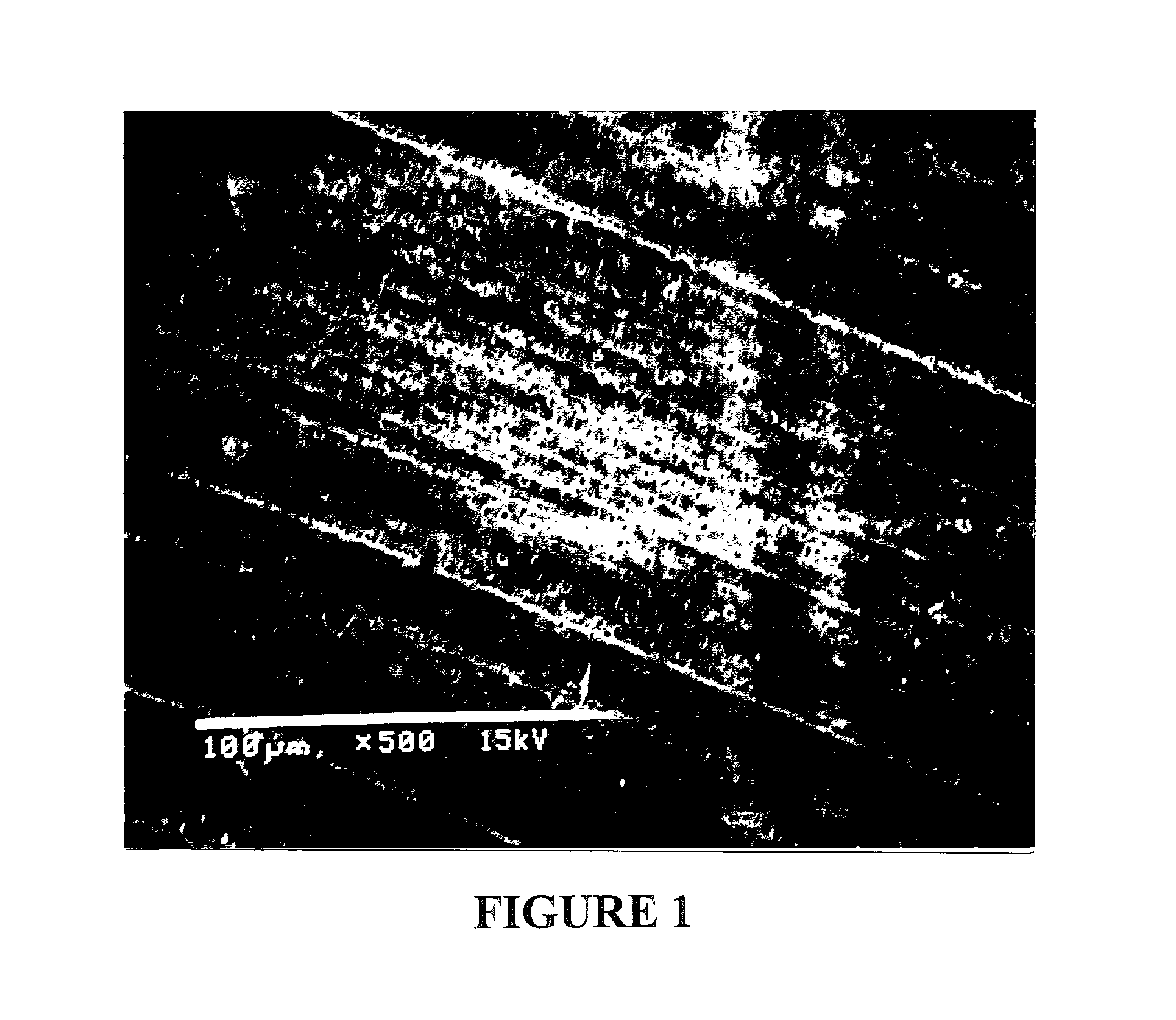 Method of etching and priming a tooth
