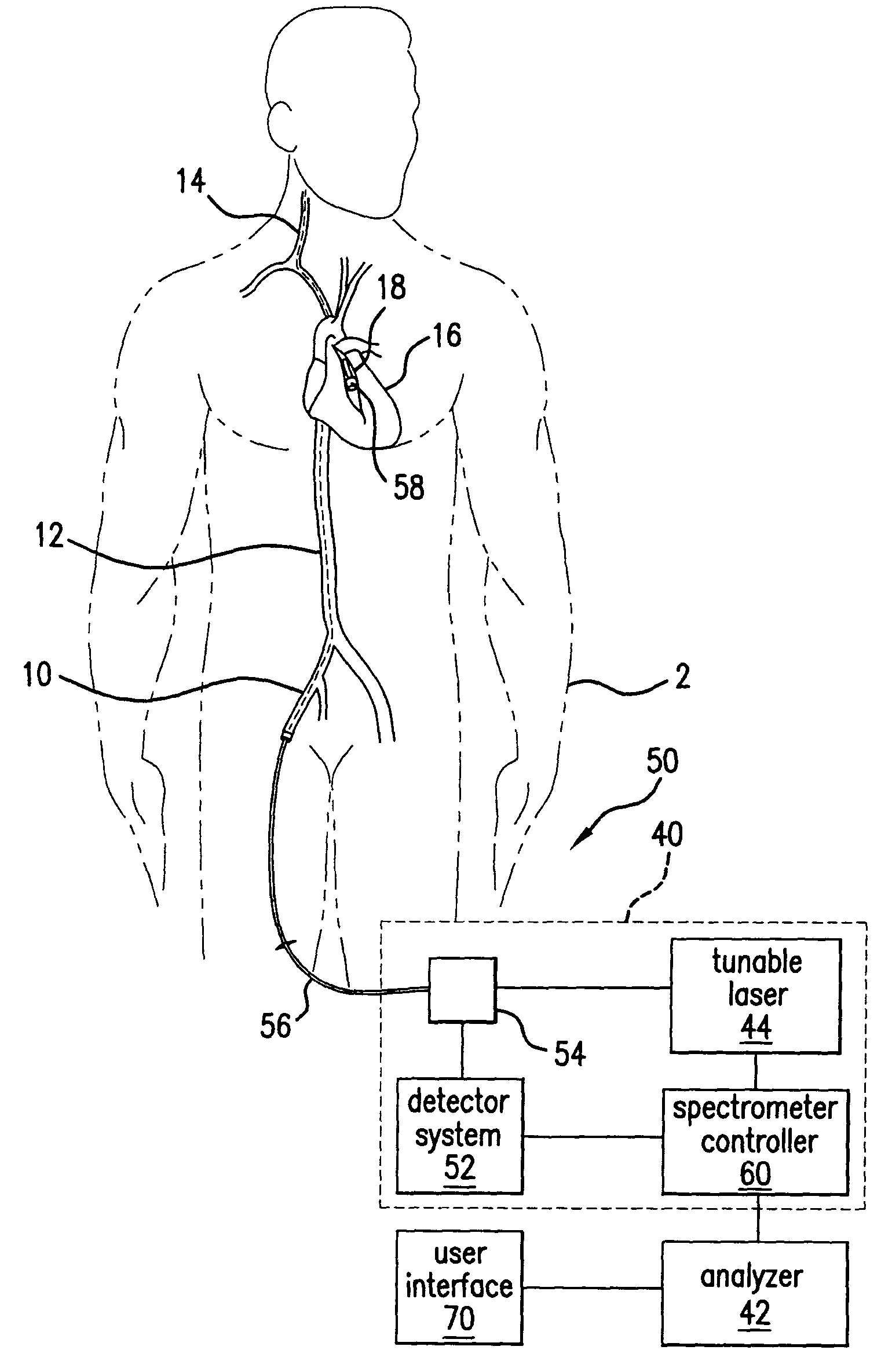Method and system for spectral examination of vascular walls through blood during cardiac motion