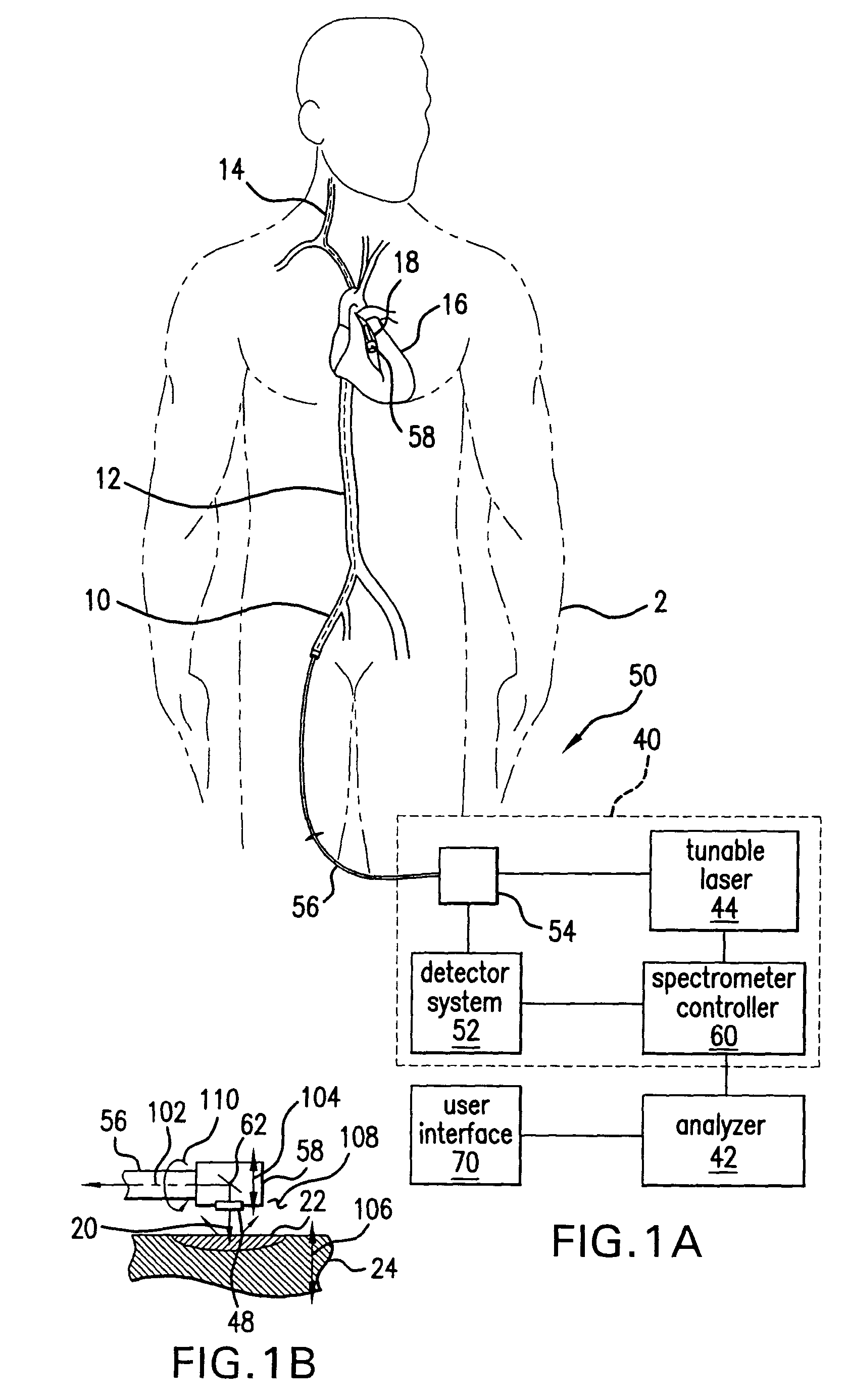 Method and system for spectral examination of vascular walls through blood during cardiac motion