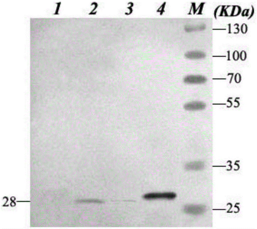 Recombinant bcg live bacterial strain expressing and secreting Staphylococcus aureus enterotoxin protein, live bacterial vaccine and its construction method and application