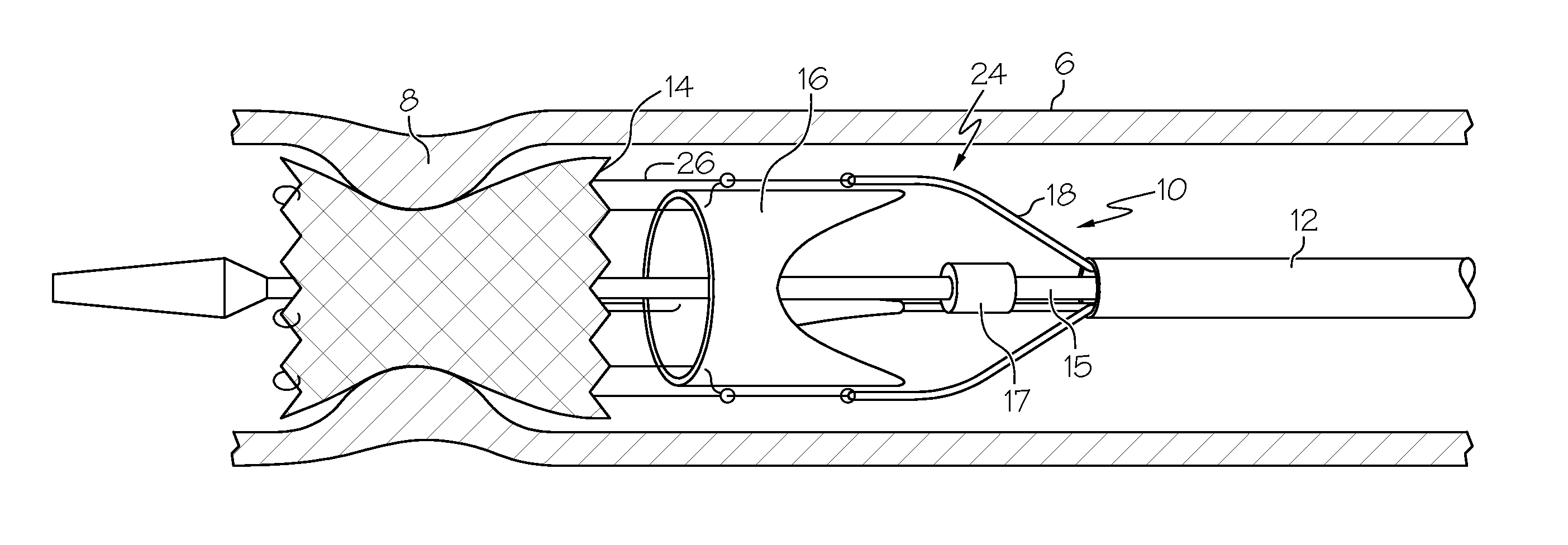 Low Profile Heart Valve Delivery System and Method
