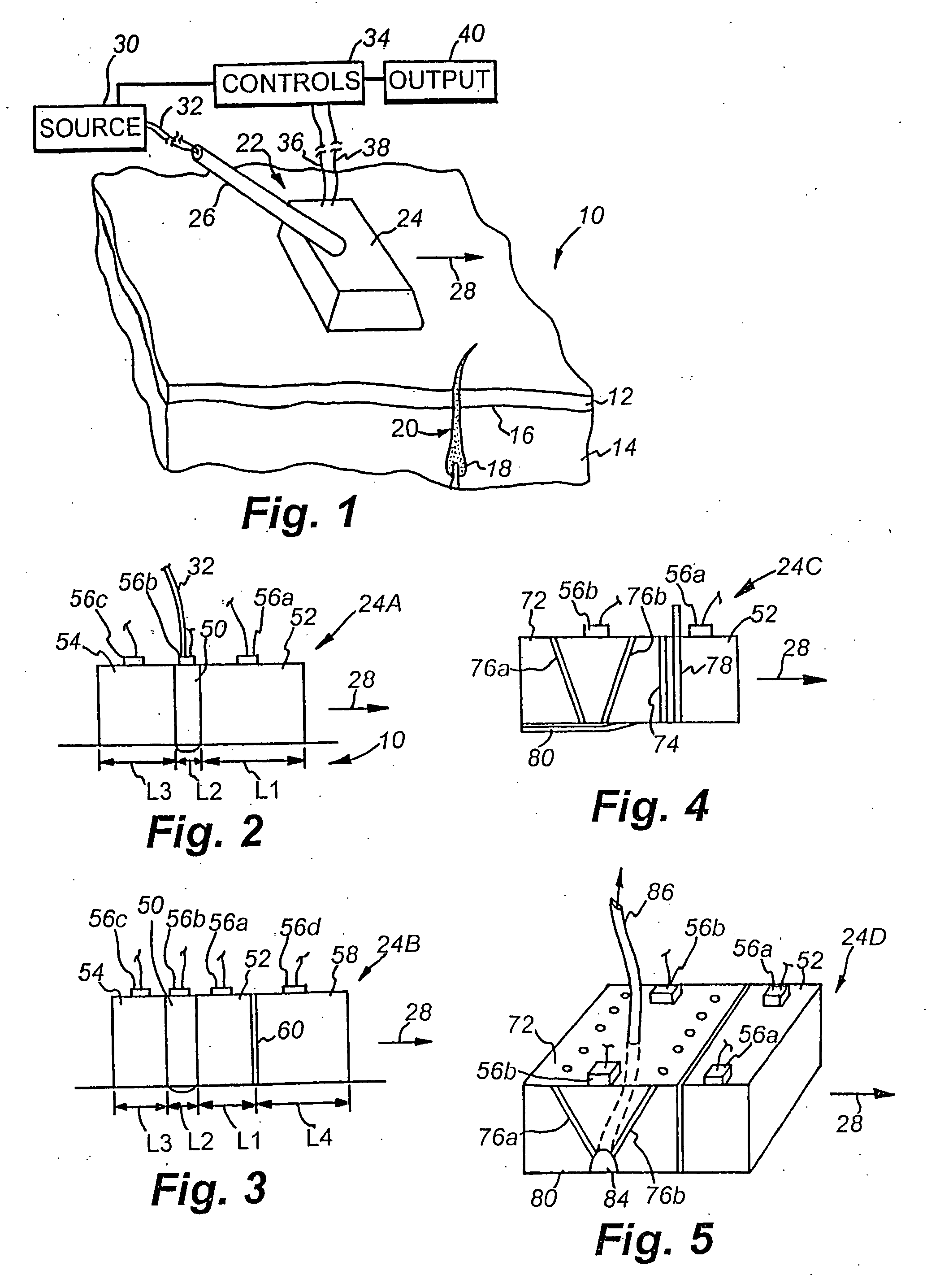 Method and apparatus for therapeutic EMR treatment on the skin