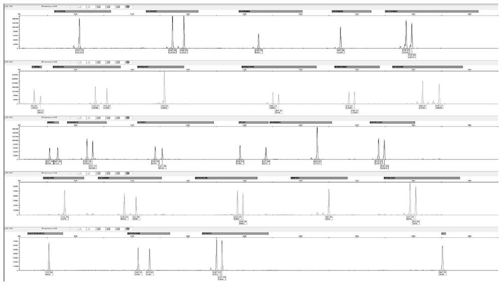 Amplification composition for chromosome aneuploid number abnormality and application thereof