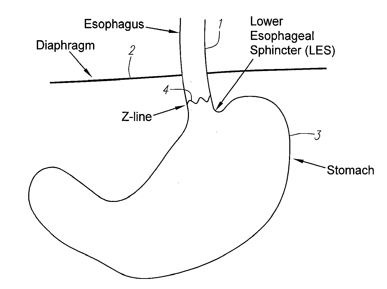 Methods and Apparatus for Testing Disruption of a Vagal Nerve