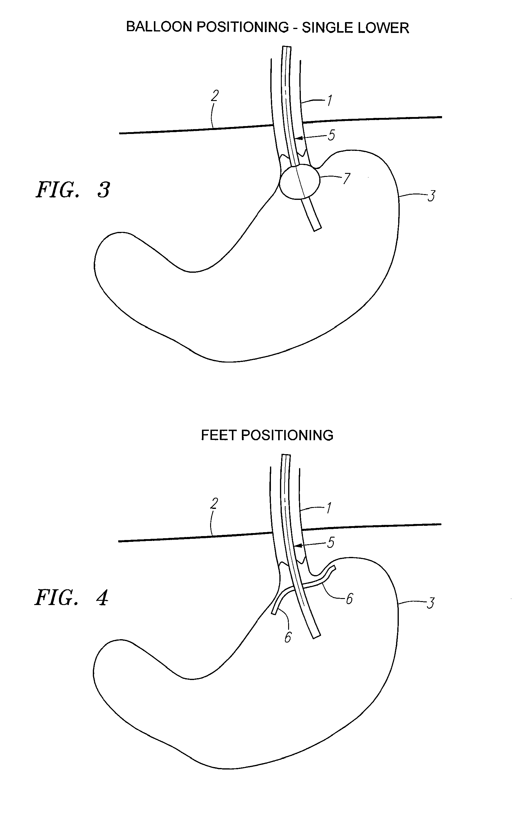 Methods and Apparatus for Testing Disruption of a Vagal Nerve