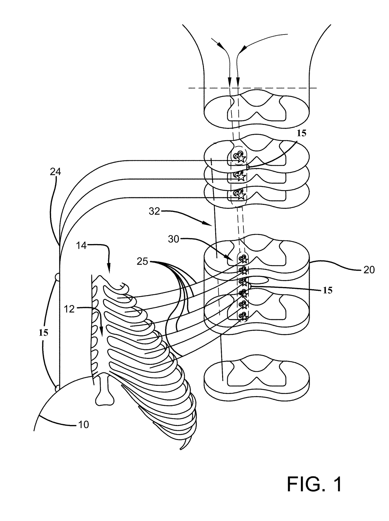 System and method for activating inspiratory and expiratory muscle function