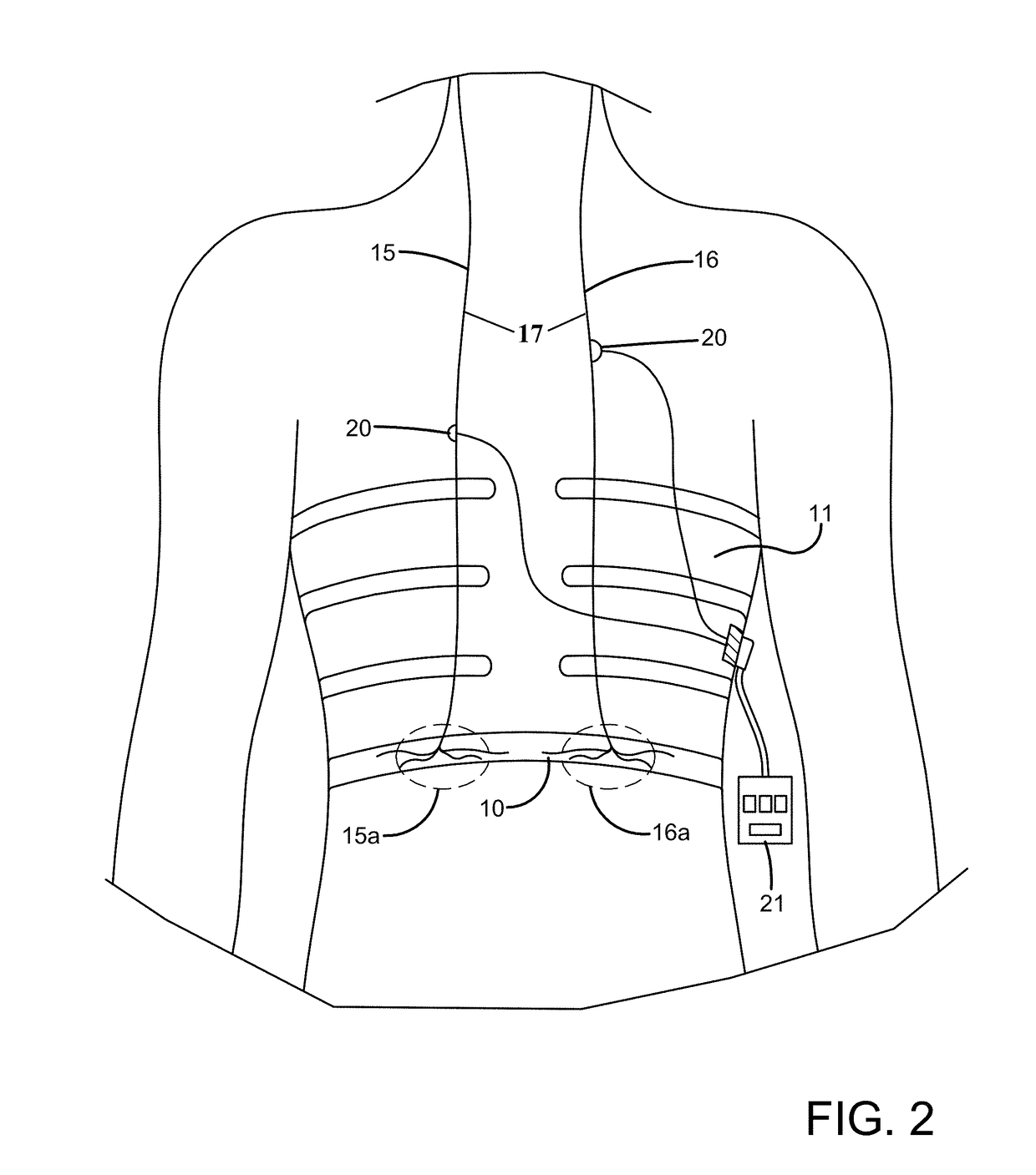 System and method for activating inspiratory and expiratory muscle function