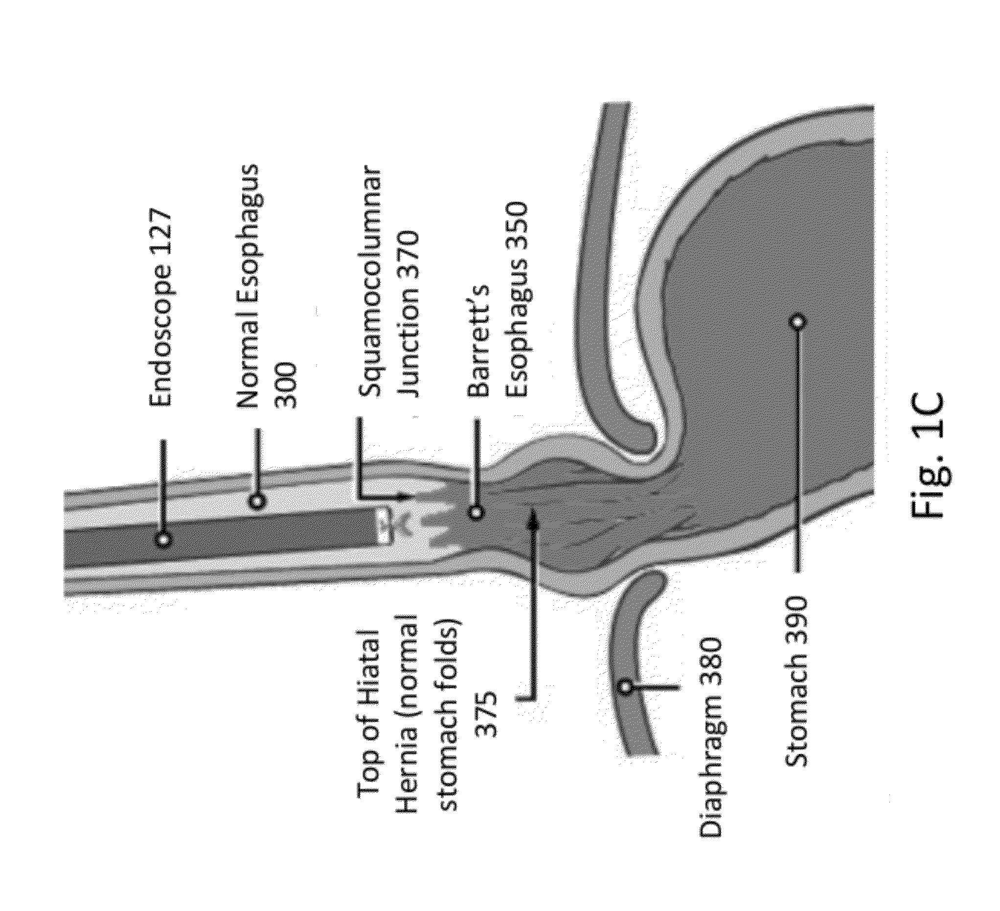 Diode laser systems and methods for endoscopic treatment of tissue