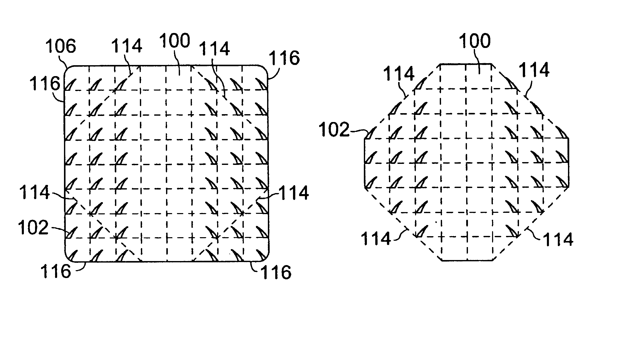 Multi-point tension distribution system device and method of tissue approximation using that device to improve wound healing