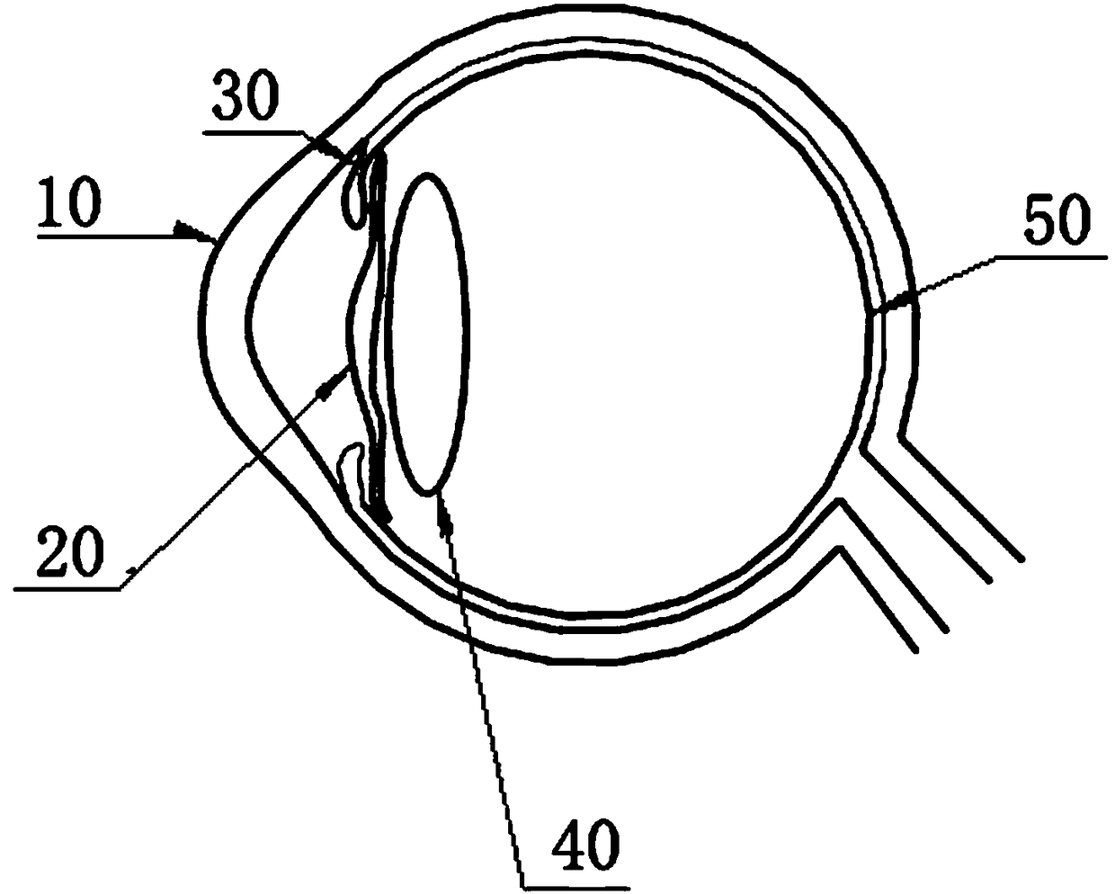 Corneal Graft Cascading Method for Improving the Diopter of Tissue-Engineered Artificial Cornea