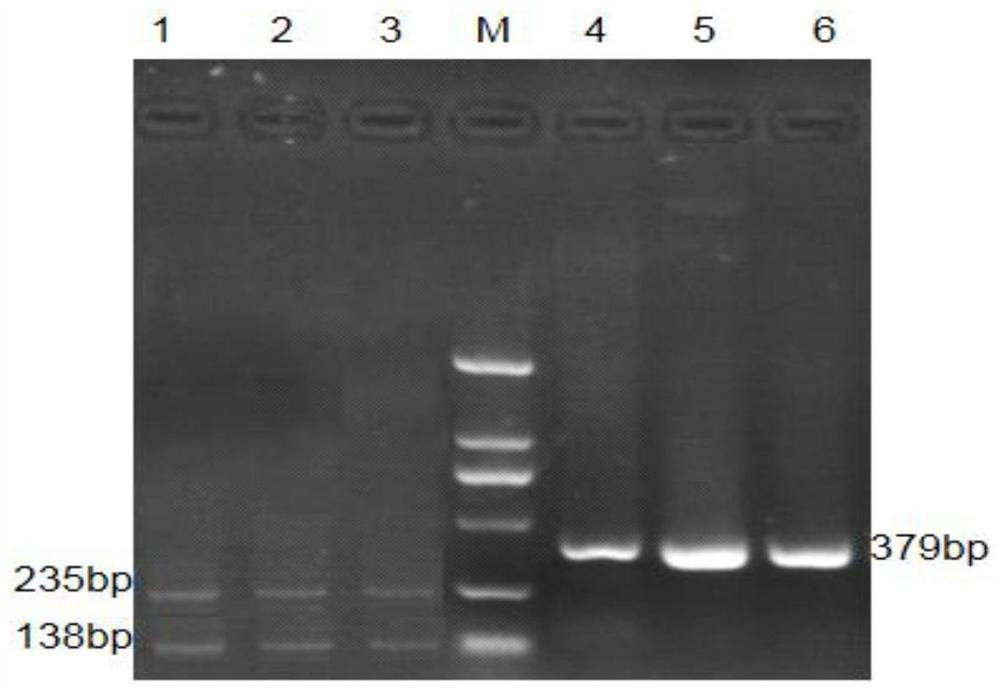 Corn saline-alkaline tolerance related molecular marker developed based on transcription factor gene ZmNAC89 and application thereof