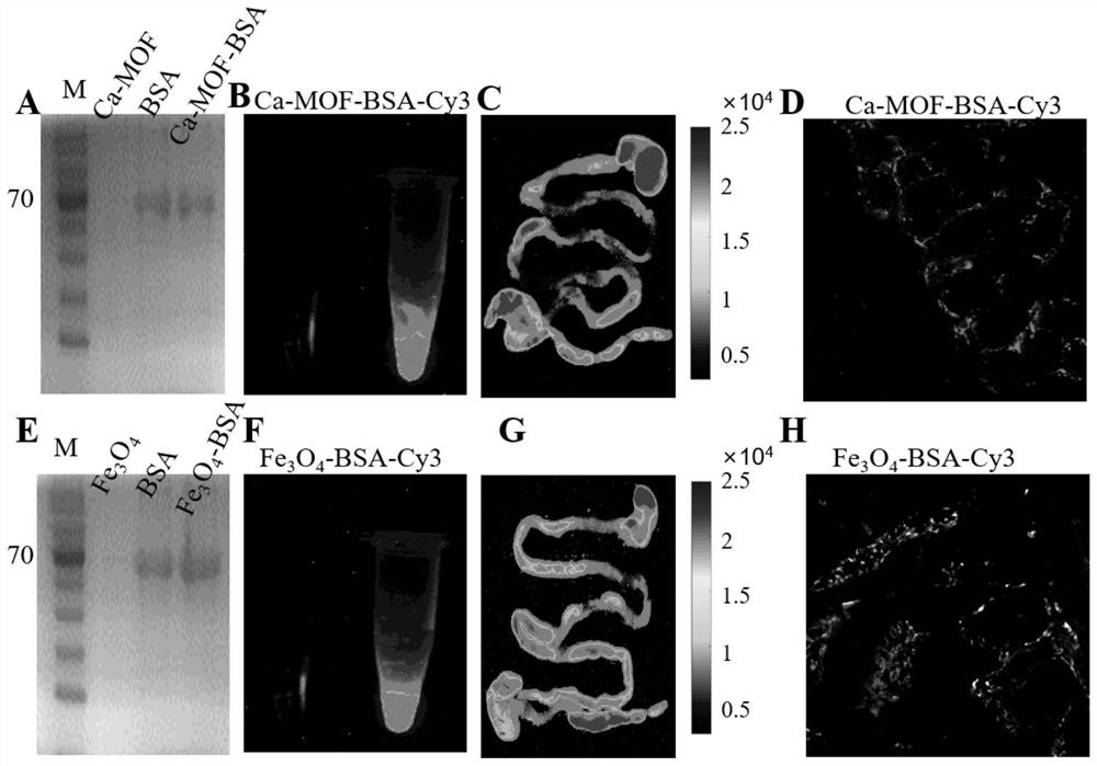 Application of nano material in preparation of nasal nano preparation for brain-targeted delivery of intestinal drugs