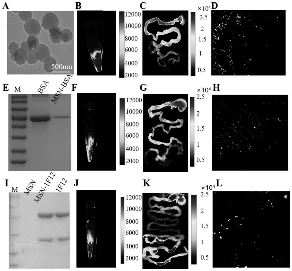 Application of nano material in preparation of nasal nano preparation for brain-targeted delivery of intestinal drugs