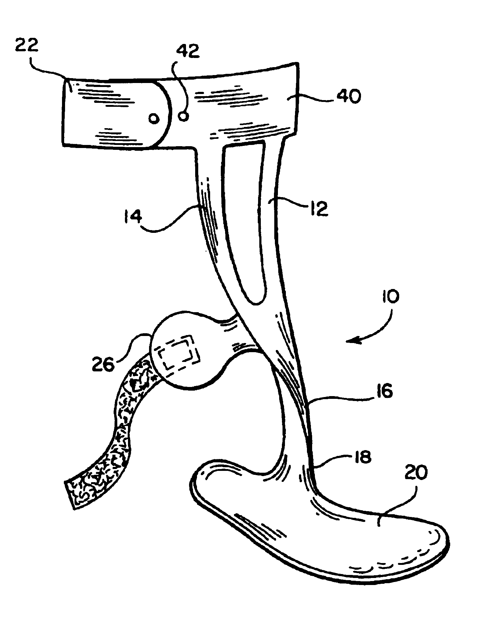 Ankle-foot orthosis
