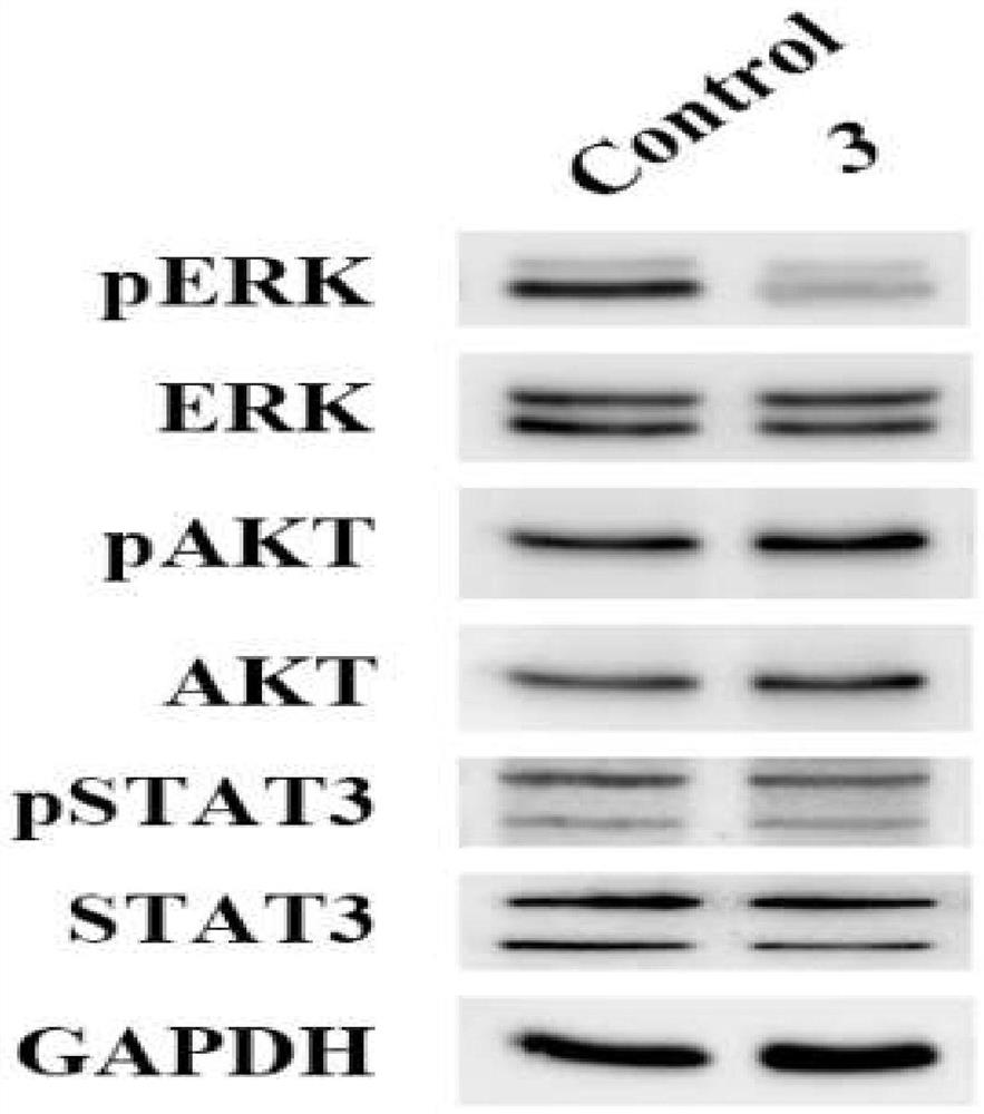 Compound separated from spina glandulifera as well as preparation method and application of compound