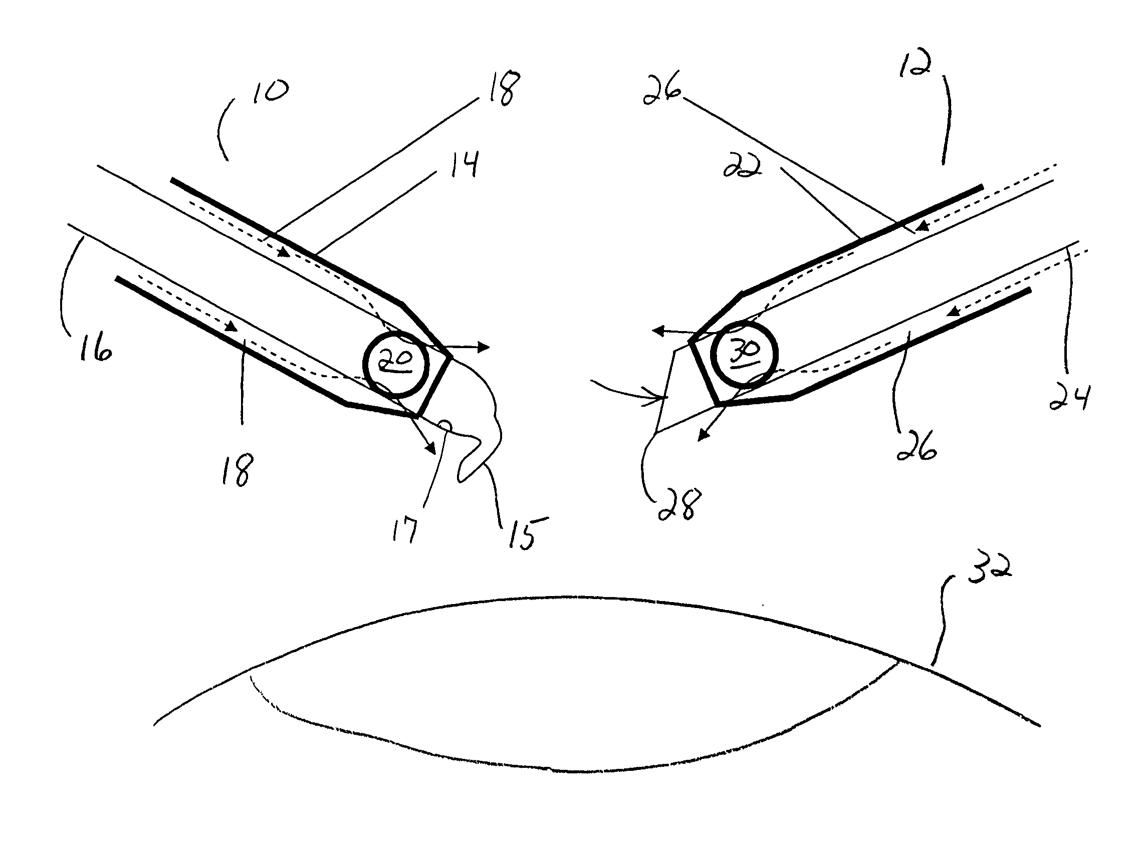 Surgical method and apparatus