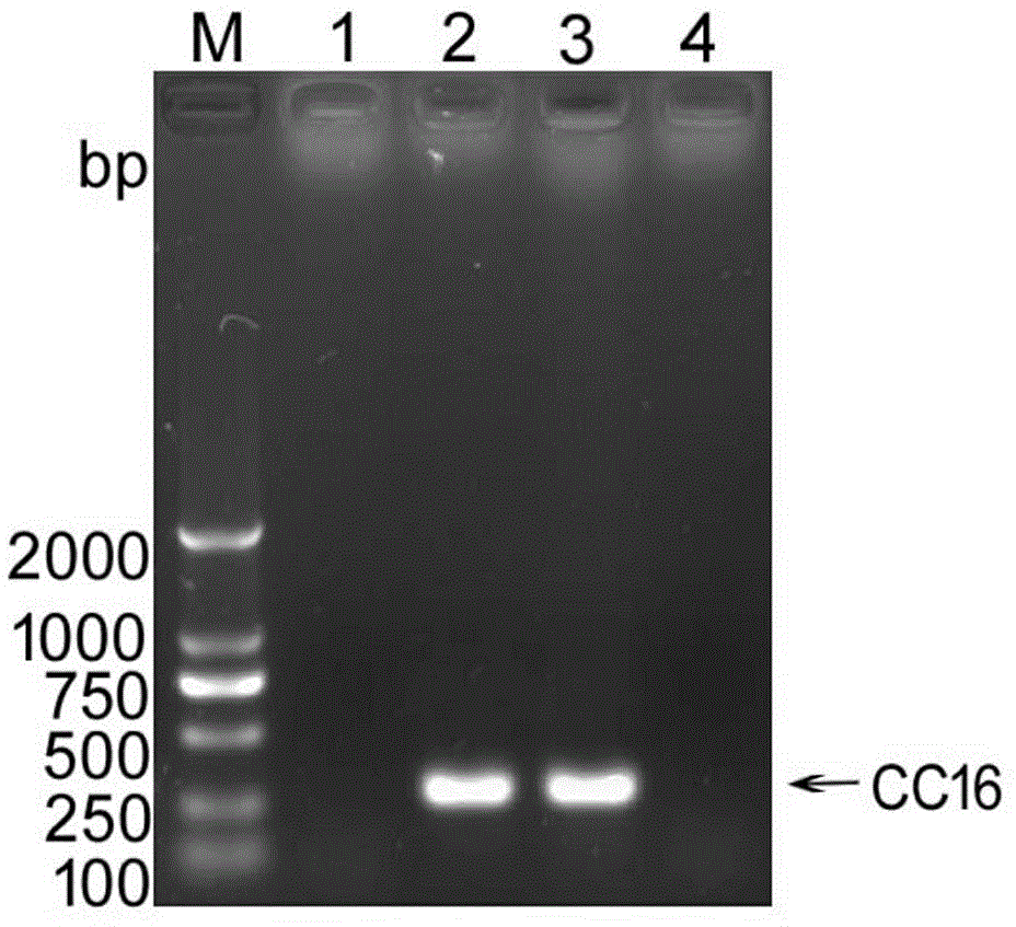 Recombinant human CC16 gene, construction of eukaryotic expression vector of CC16 gene, and purification of recombinant protein