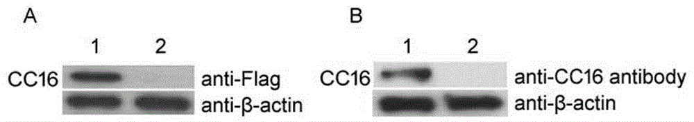Recombinant human CC16 gene, construction of eukaryotic expression vector of CC16 gene, and purification of recombinant protein