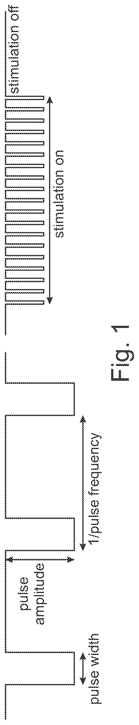 Control system for closed-loop neuromodulation